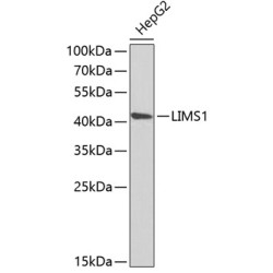 LIMS1 Rabbit pAb