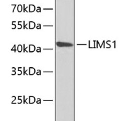 LIMS1 Rabbit pAb