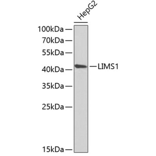 LIMS1 Rabbit pAb