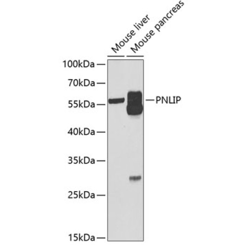 PNLIP Rabbit pAb