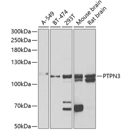 PTPN3 Rabbit pAb