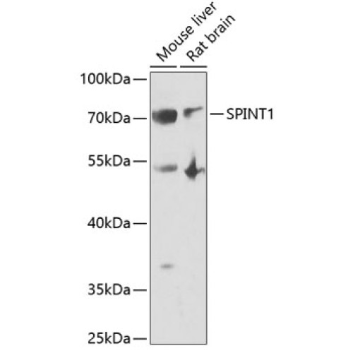 SPINT1 Rabbit pAb