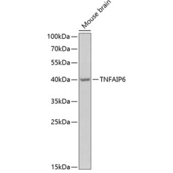 TNFAIP6 Rabbit pAb
