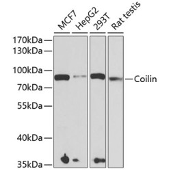 Coilin Rabbit pAb