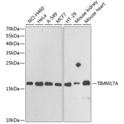 TIMM17A Rabbit pAb