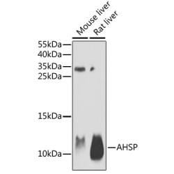 AHSP Rabbit pAb