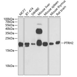 PTRH2 Rabbit pAb