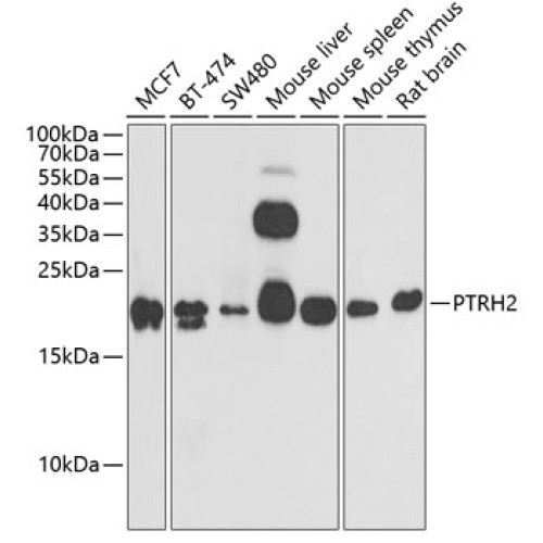 PTRH2 Rabbit pAb