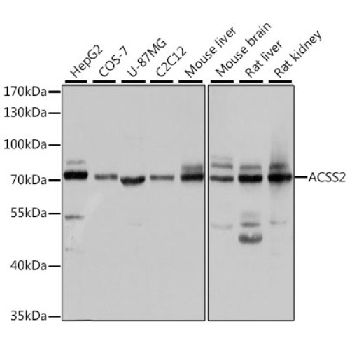 ACSS2 Rabbit pAb