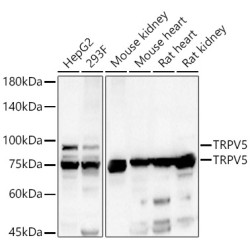 TRPV5 Rabbit pAb