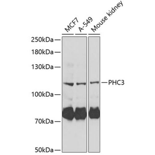 PHC3 Rabbit pAb