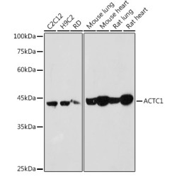 ACTC1 Rabbit pAb