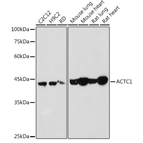 ACTC1 Rabbit pAb
