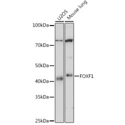 FOXF1 Rabbit mAb