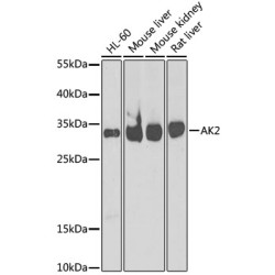 [KO Validated] AK2 Rabbit pAb