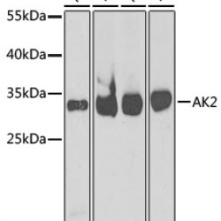 [KO Validated] AK2 Rabbit pAb