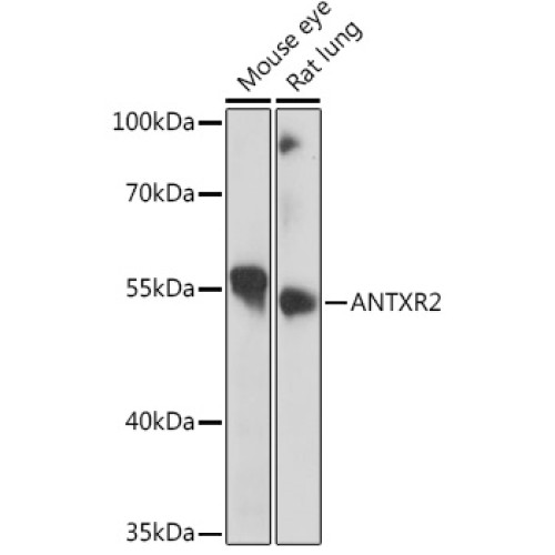 ANTXR2 Rabbit pAb