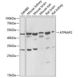ATP6AP2 Rabbit pAb