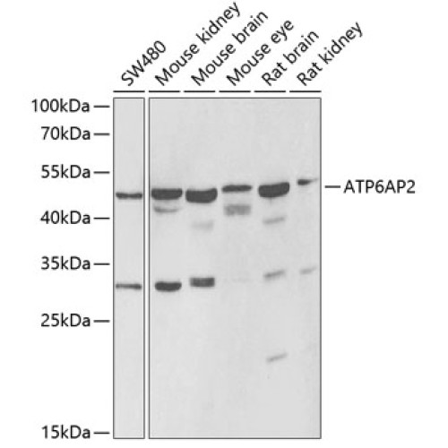 ATP6AP2 Rabbit pAb