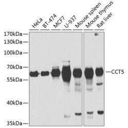 CCT5 Rabbit pAb