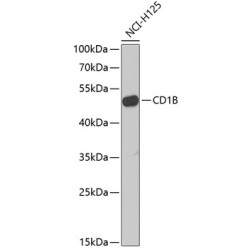 CD1B Rabbit pAb