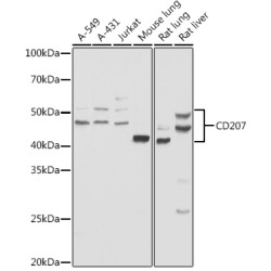 Langerin/CD207 Rabbit pAb