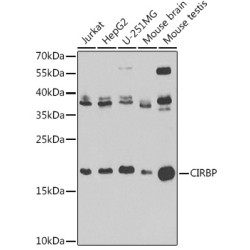 [KO Validated] CIRBP Rabbit pAb