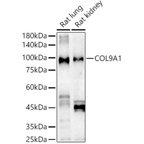 COL9A1 Rabbit pAb