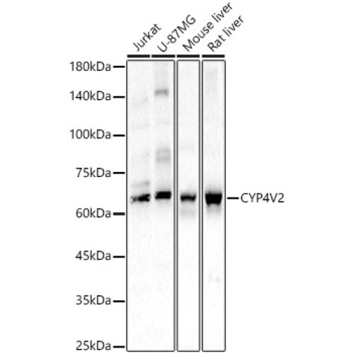 CYP4V2 Rabbit pAb