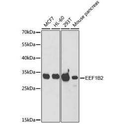 [KO Validated] EEF1B2 Rabbit pAb