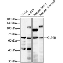 GLP2R Rabbit pAb