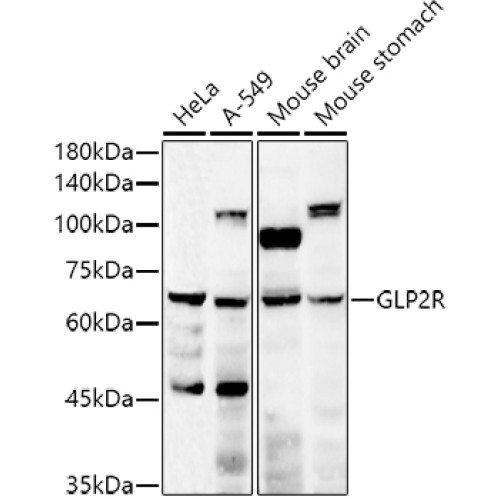 GLP2R Rabbit pAb