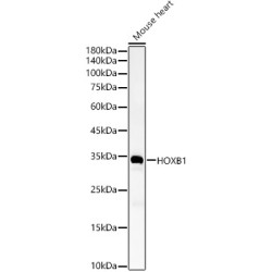 HOXB1 Rabbit pAb