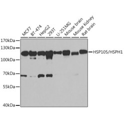 HSP105/HSPH1 Rabbit pAb