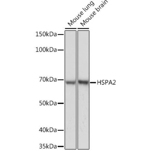 HSPA2 Rabbit mAb
