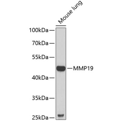 MMP19 Rabbit pAb