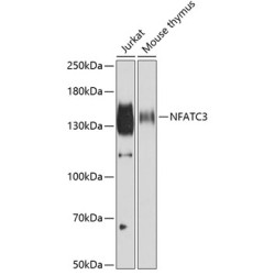 NFATC3 Rabbit pAb