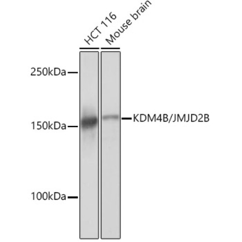 KDM4B/JMJD2B Rabbit mAb