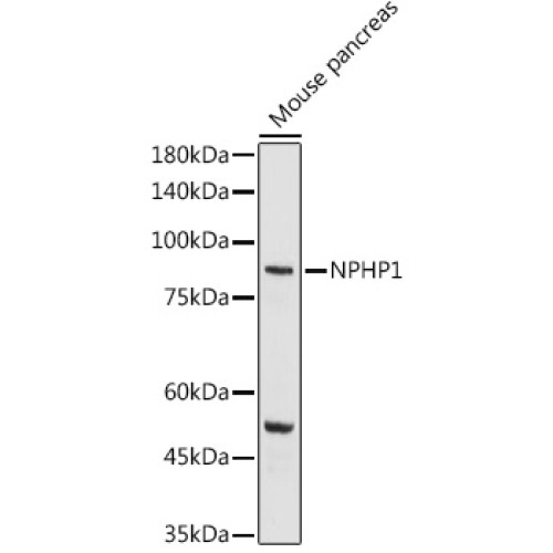 NPHP1 Rabbit pAb