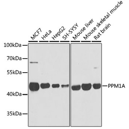 PPM1A Rabbit pAb