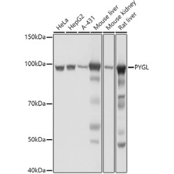 PYGL Rabbit pAb