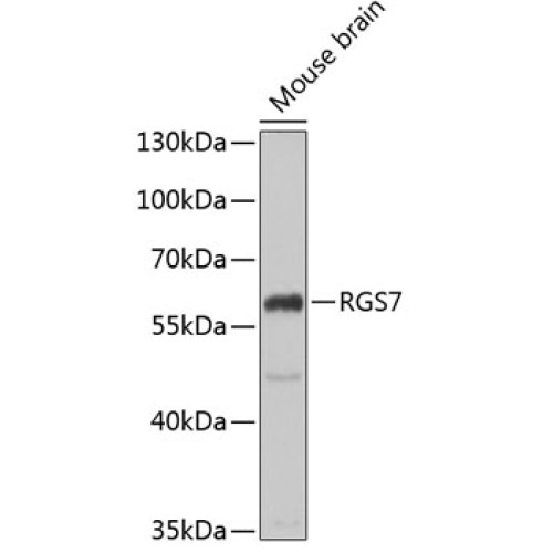RGS7 Rabbit pAb