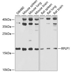 RPLP1 Rabbit pAb