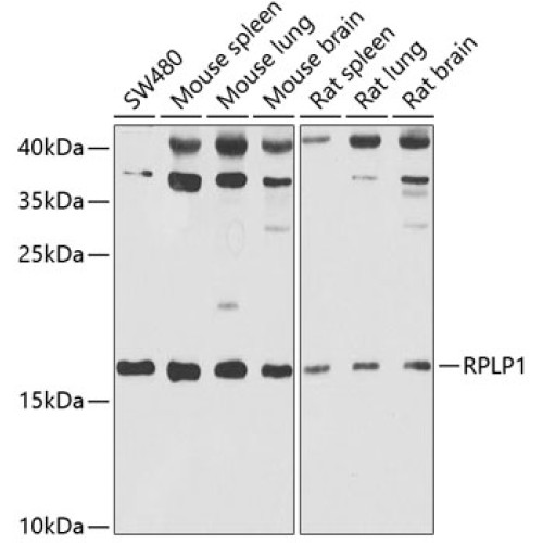 RPLP1 Rabbit pAb