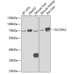 SLC20A2 Rabbit pAb