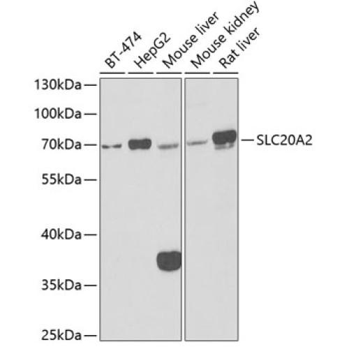 SLC20A2 Rabbit pAb