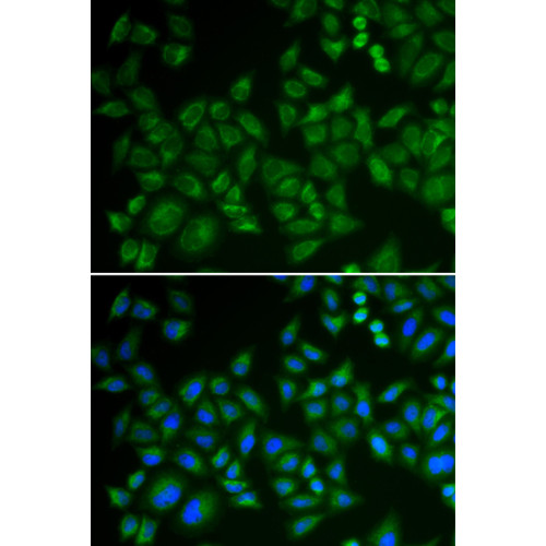 SMPD1 / ASM Rabbit pAb