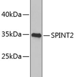 SPINT2 Rabbit pAb