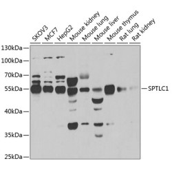 SPTLC1 Rabbit pAb