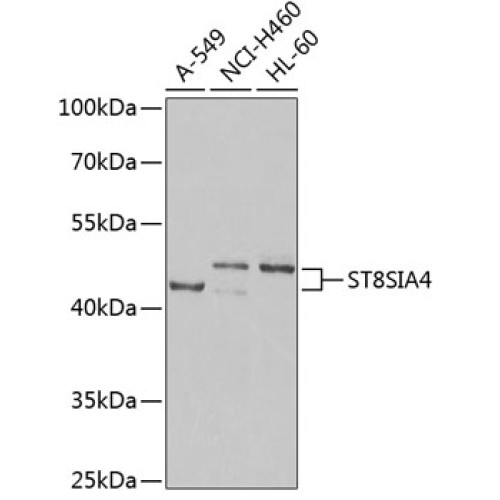 ST8SIA4 Rabbit pAb